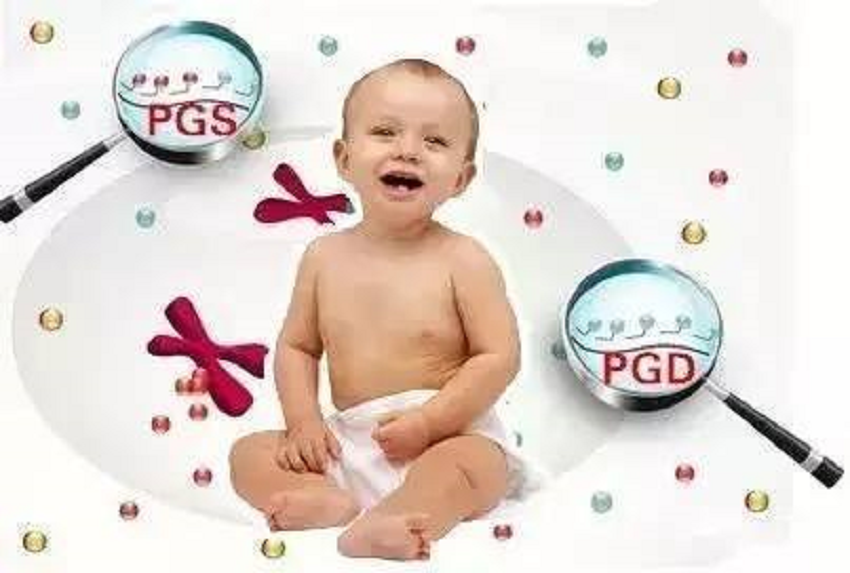 探究PGD技术中的卵子采集次数，如何确保筛查的准确性和效率
