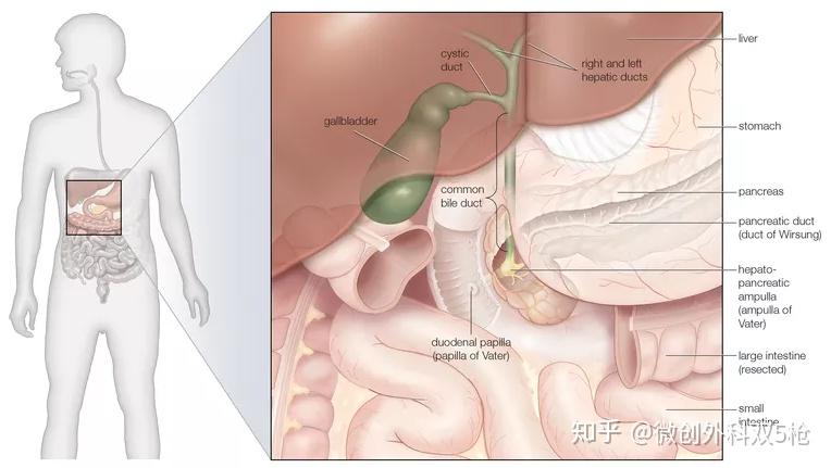 取卵后肚子腹水的症状