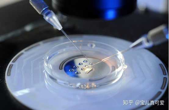 取卵后孕酮高能移植吗——关于试管婴儿移植的探讨