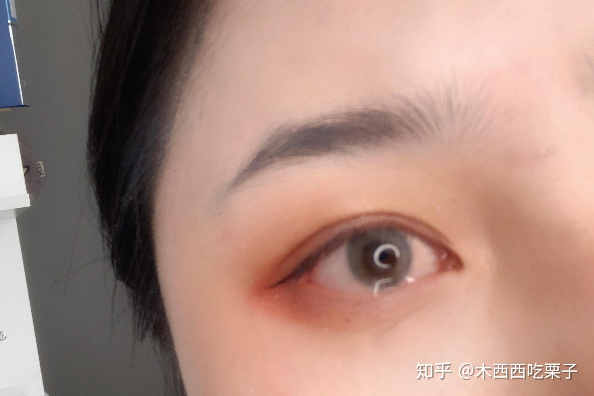 美瞳有真假吗？——深度探讨美瞳市场的真实面貌
